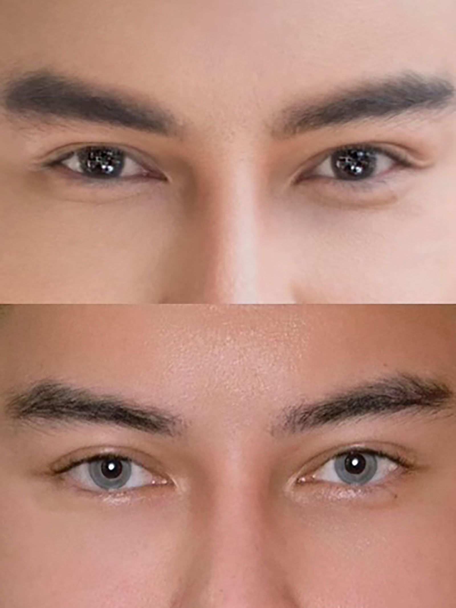 goz-rengi-degistirme-oncesi-sonrasi